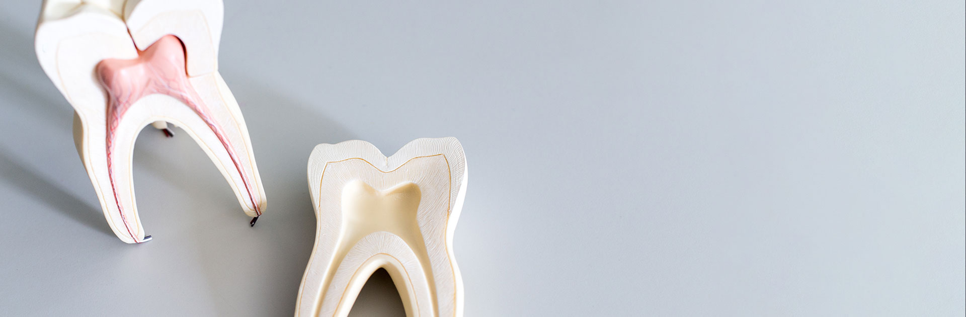 root-canal-banner