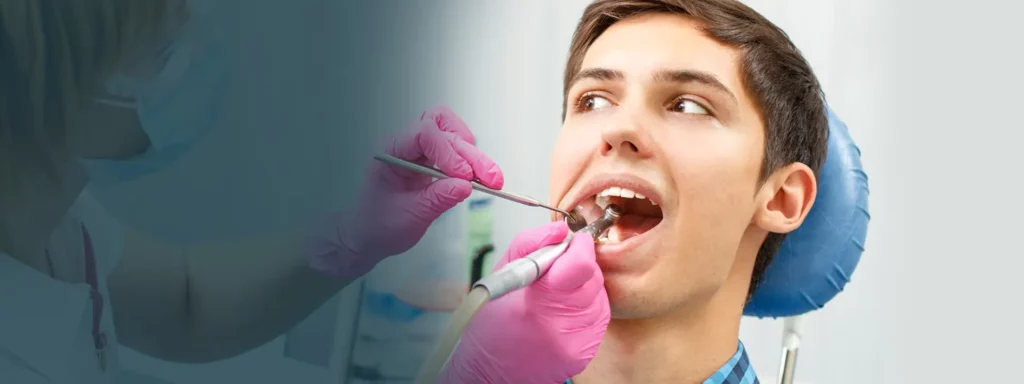 root-canal-banner