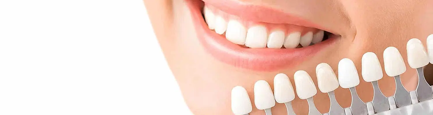 root-canal-banner