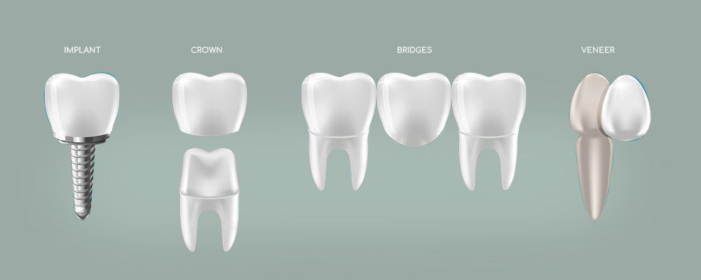root-canal-banner