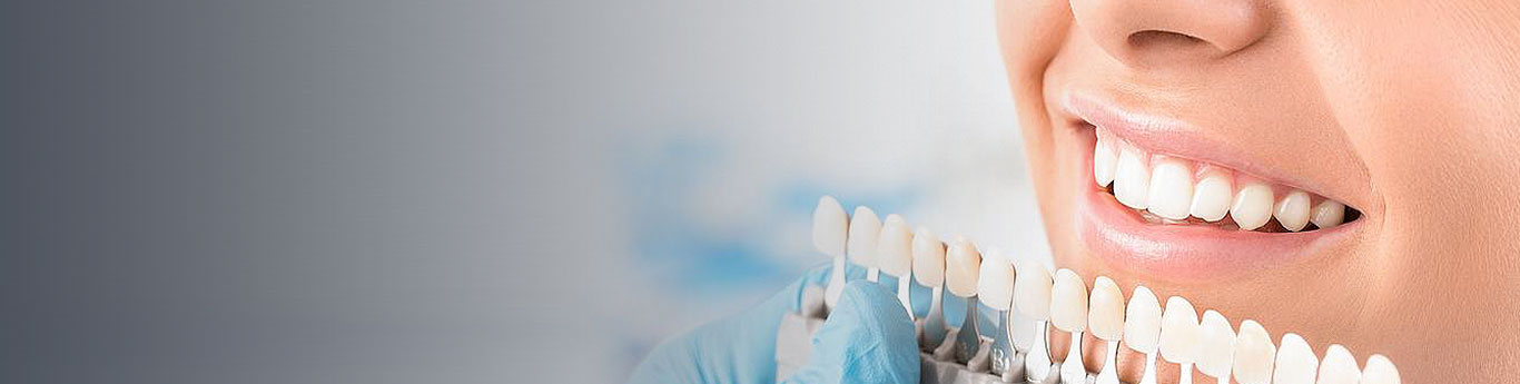 root-canal-banner