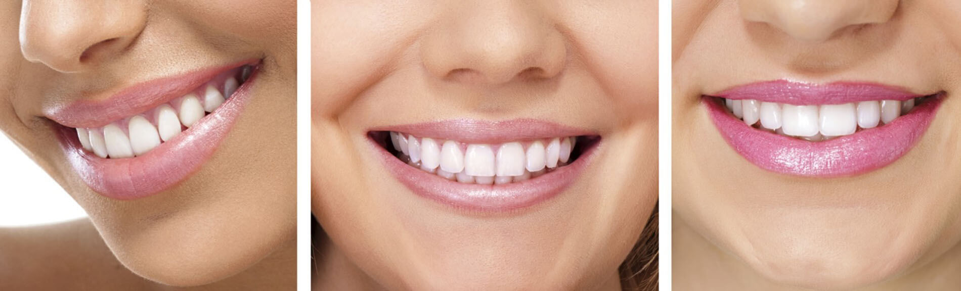 root-canal-banner