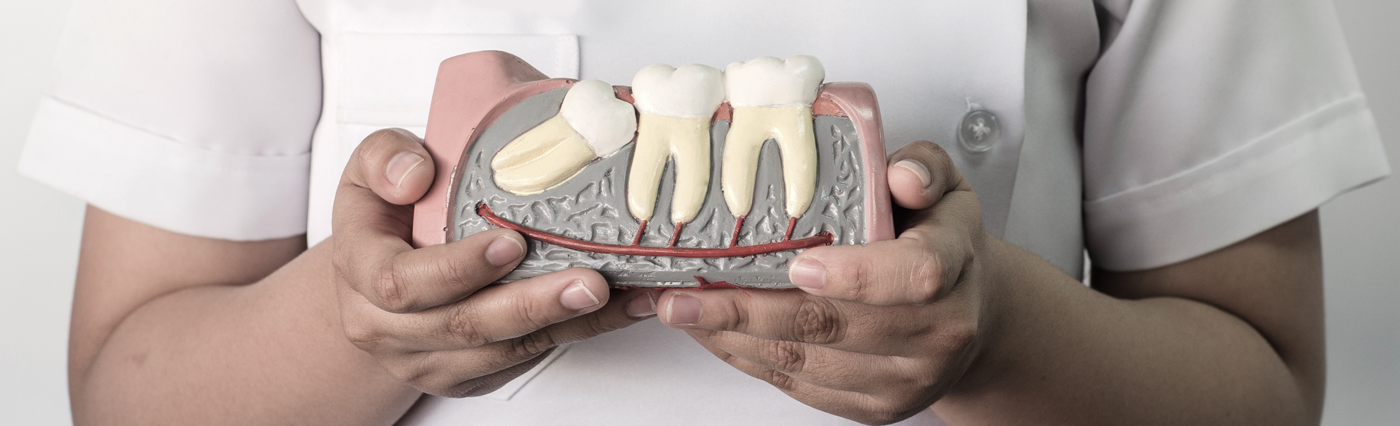 root-canal-banner